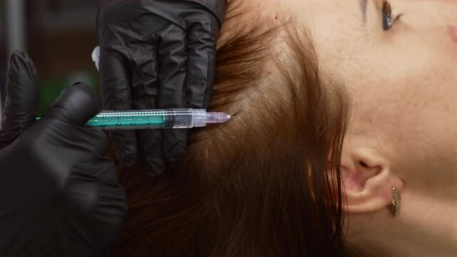 Doctor performing plasma therapy injection into scalp for hair regeneration. Cosmetologist using syringe to deliver PRP treatment for healthy hair growth. Aesthetic specialist applying mesotherapy