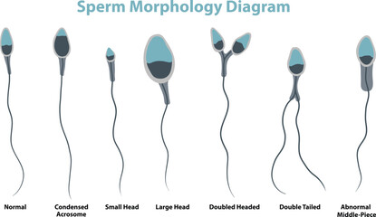 illustration of sperm morphology diagram