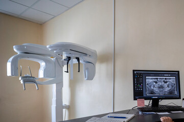 A modern X-Mind Prime panoramic dental X-ray machine, an orthopantomograph, displays a digital dental image on its monitor in a clinic setting.