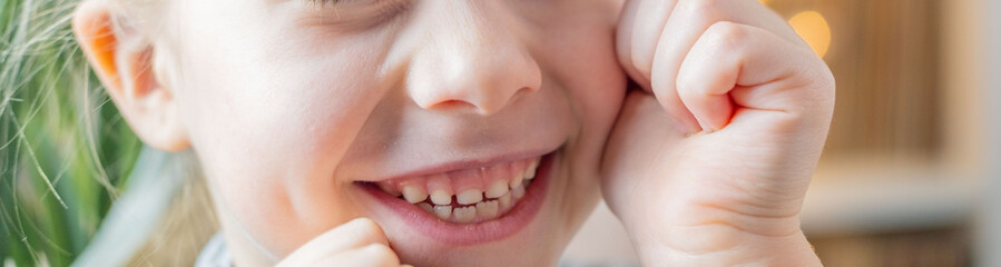 joyful smile small child, innocent gaze blonde girl 5 years old with missing teeth, curiosity and...