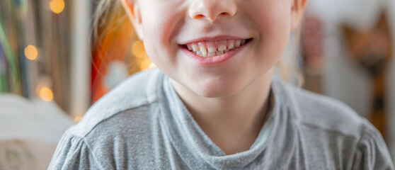joyful smile small child, innocent gaze blonde girl 5 years old with missing teeth, curiosity and...