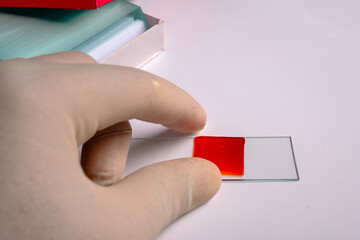 Preparing blood smear on slide for microscopic examination