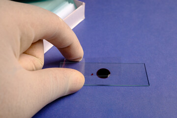 Preparing blood smear on slide for microscopic examination