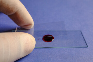 Preparing blood smear on slide for microscopic examination