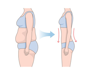 Women's body changes before and after fitness. Woman's body with fat belly and slender beautiful figure. Weight loss comparison