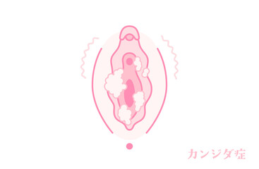 膣カンジダのある女性器（外陰部）