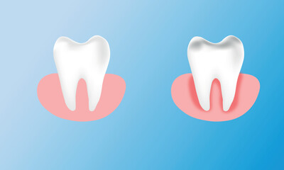 3d rendered illustration of a tooth