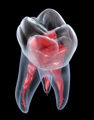 Dental root anatomy - First maxillary molar tooth. Dental 3D illustration