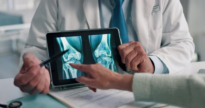 Doctor, hands and tablet for x ray with knee, bones and osteoporosis with point at hospital. People, touchscreen and medical consultation for arthritis, feedback and report for wellness at clinic
