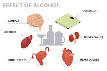 Effects of alcohol on human body, infographic. Alcoholism disease health care concept. 3d flat isometric vector illustration.
