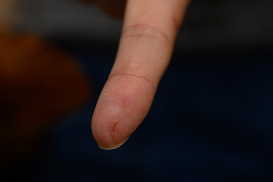 Injured woman showing a bleeding finger cut, possibly from a kitchen knife.