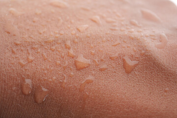 Close-up of skin with beads of water after physical activity