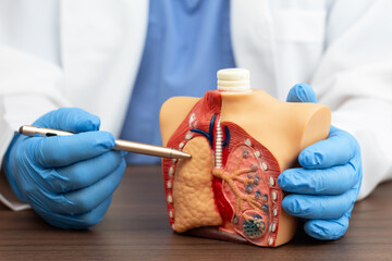 A pulmonologist explains lung diseases using an anatomical model showing the alveoli. Medical...