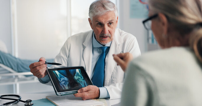 Doctor, patient and tablet for x ray with knee, screen and osteoporosis with point at hospital. People, application and medical consultation for arthritis, feedback and report for wellness at clinic - Powered by Adobe