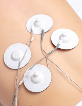 Close-Up of ECG Pads on Human Body