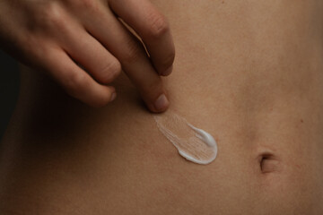 Applying Moisturizing Cream on Skin for Hydration and Care