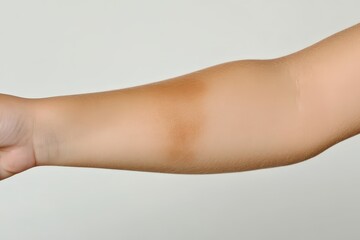 A child's arm showing a noticeable area of discoloration.
