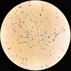 Human glioma cells.