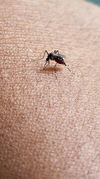 In a close-up video, a mosquito on human skin. The mosquito bite sucks blood, Aedes albopictus.