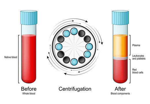 Whole blood in the test tube before and after Centrifugation