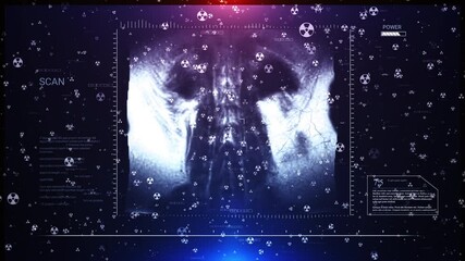 Medical Scan Analysis: Biohazard Symbols Overlay - Powered by Adobe