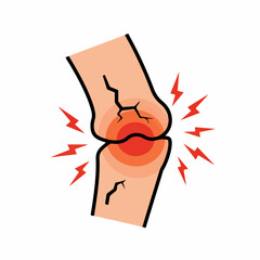 Injured knee joint illustration with cracks and red inflammation. This medical illustration shows knee pain and bone damage.  Graphic depicts sharp pain,