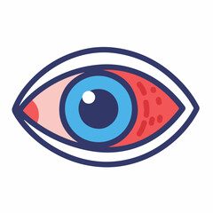 Red eye illustration. Detailed anatomy shows blood vessels and iris.  Inflammatory process depicted for ophthalmology educational materials.