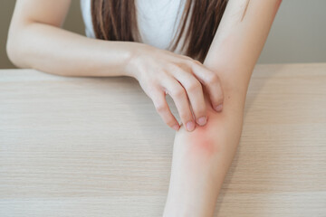 Close-up of young woman scratch her arm have a red rash