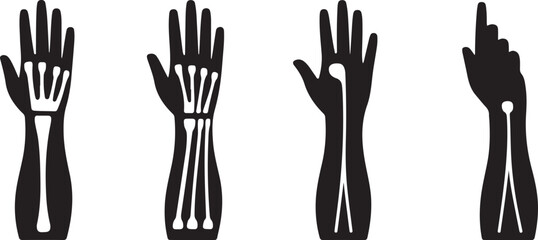 Four Black Silhouettes of Hands Showing Bone Structure