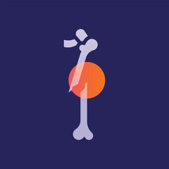 Femoral fracture  glassmorphism illustration.