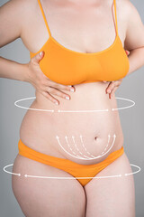 Full body liposuction, legs, hips, abdomen and breast augmentation, fat and cellulite removal...