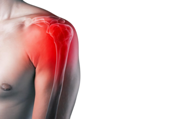 Inflamed shoulder (Turns slightly red). isolated on transparent or white background