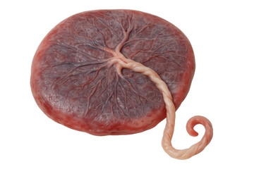 Medical specimen showing placenta and umbilical cord, revealing intricate biological connection against transparent background