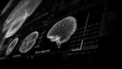 Futuristic biomedical concept featuring advanced holographic scanning technology performing detailed brain neuron pathology and diagnostic analysis. High-tech medical visualizing neural network