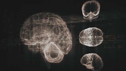 Futuristic biomedical concept featuring advanced holographic scanning technology performing detailed brain neuron pathology and diagnostic analysis. High-tech medical visualizing neural network