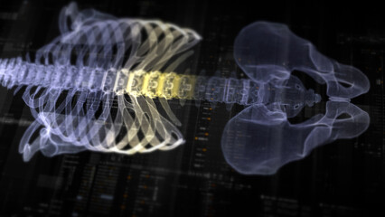 Futuristic biomedical concept with advanced holographic scanning and HUD diagnosing spinal disc herniation using 3D holograms of a patient’s backbone, AR, and real-time medical imaging