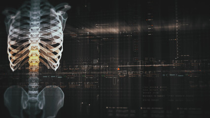 Futuristic biomedical concept with advanced holographic scanning and HUD diagnosing spinal disc herniation using 3D holograms of a patient’s backbone, AR, and real-time medical imaging