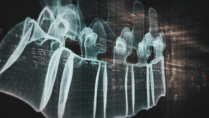 Futuristic biomedical concept with advanced holographic scanning and HUD diagnosing spinal disc herniation using 3D holograms of a patient’s backbone, AR, and real-time medical imaging