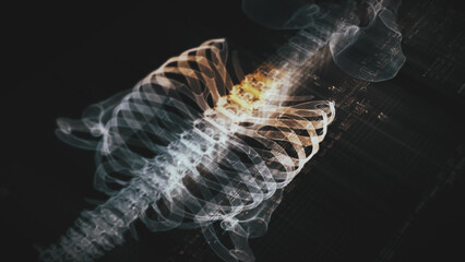 Futuristic biomedical concept with advanced holographic scanning and HUD diagnosing spinal disc herniation using 3D holograms of a patient’s backbone, AR, and real-time medical imaging