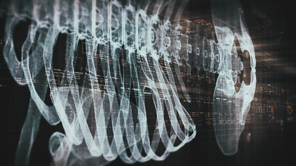 Futuristic biomedical concept with advanced holographic scanning and HUD diagnosing spinal disc herniation using 3D holograms of a patient’s backbone, AR, and real-time medical imaging