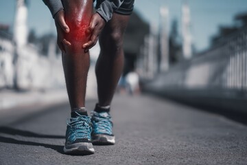 Athlete Holding Painful Knee While Running – Sports Injury and Joint Pain Concept