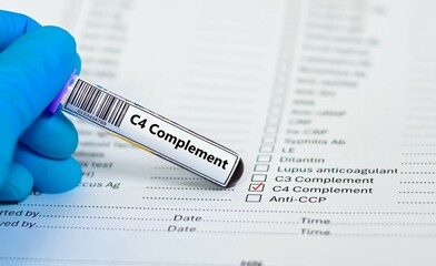 Blood sample tube and paper order request for C4 complement test analysis.