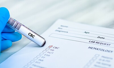 Blood sample tube and paper reqeust order for complete blood count (CBC) test analysis.