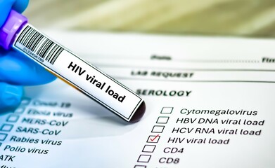 Blood sample tube and paper order request for HIV viral load.