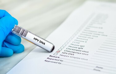 Blood sample tube and paper order request for HPV DNA test analysis.