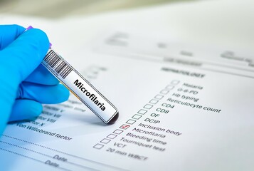 Blood sample tube and paper order request for microfilaria.