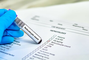 Blood sample tube and paper order request for reticulocyte count.