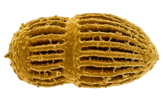 Textured golden biological particle seen with an electron microscope isolated on a transparent background