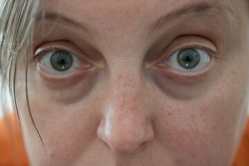 close-up of young woman's eyes looking straight into the camera, feminism, women's rights struggle