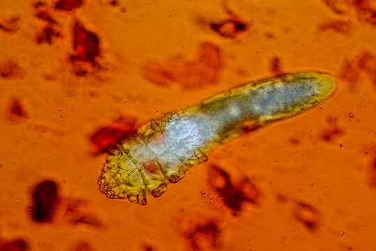 demodex face maite stained with safranin under the microscope
